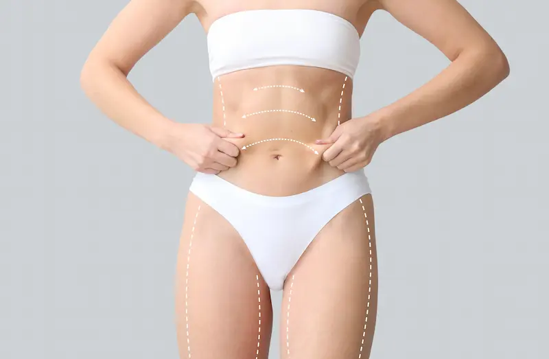 Liposuction in Turkey