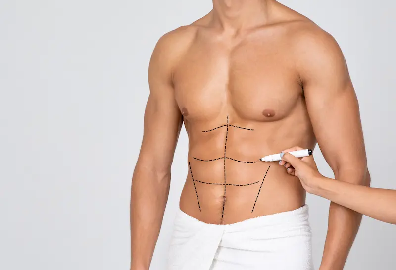 Abdominal Etching Cost Turkey