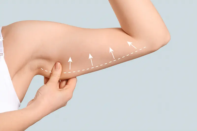 Arm Liposuction in Turkey Cost