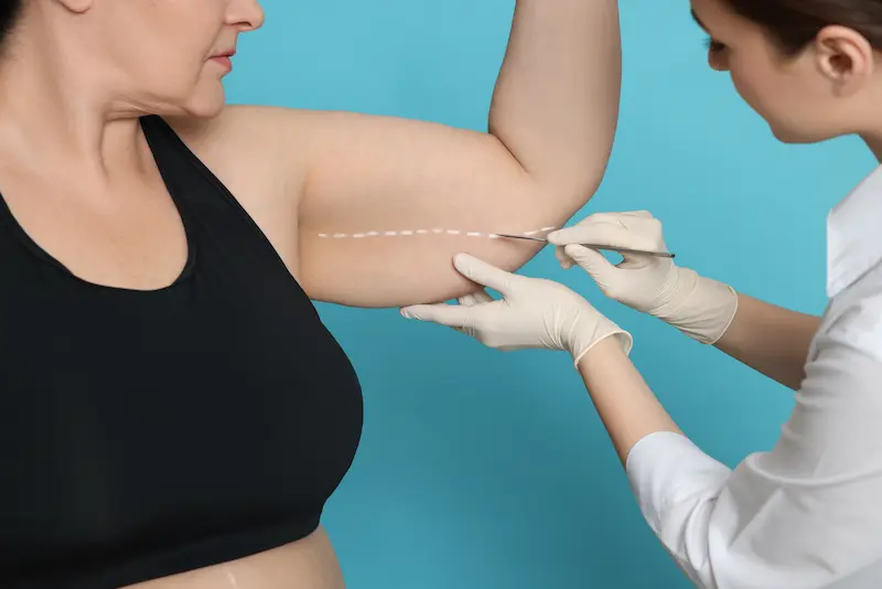 Arm Tuck Cost Turkey