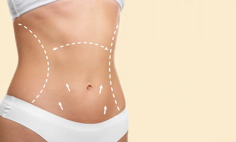 Extended Tummy Tuck Cost Turkey