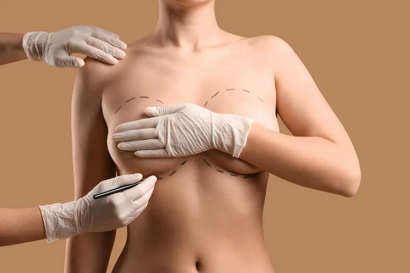 Natural Breasts vs. Breast Implants