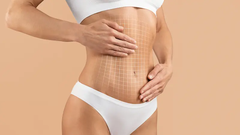 High Definition Liposuction in Turkey