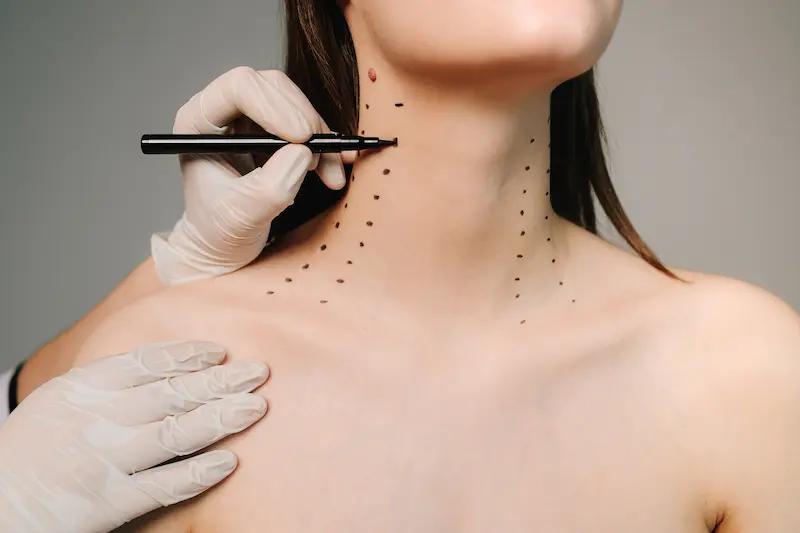 Neck Lift in Turkey