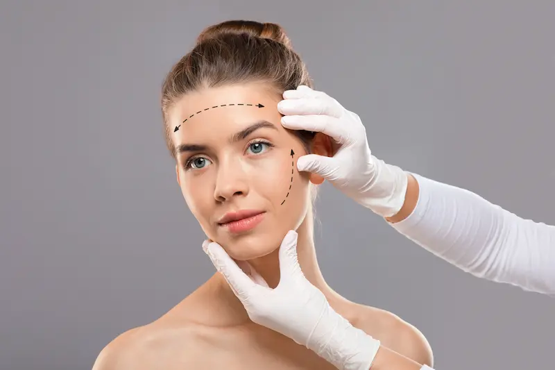 Revision Face Lift in Turkey