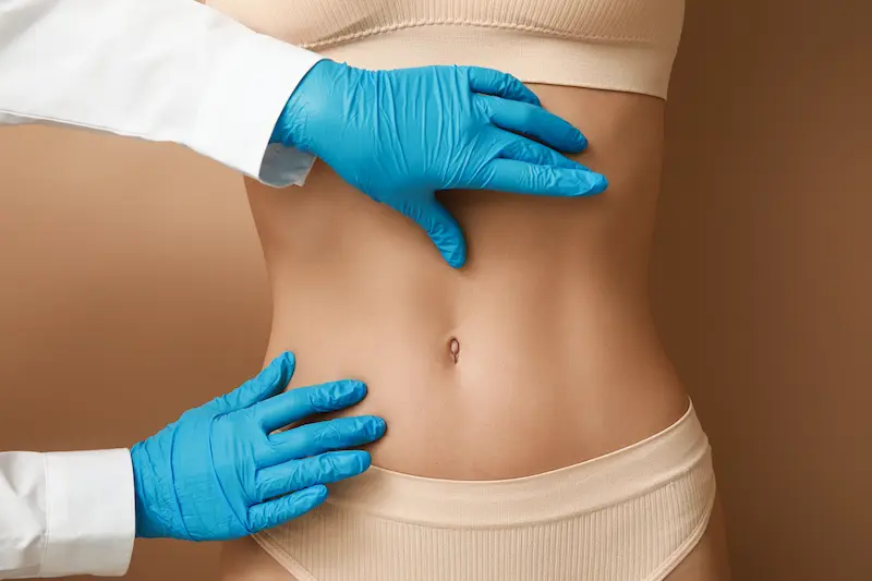 Stomach Liposuction in Turkey